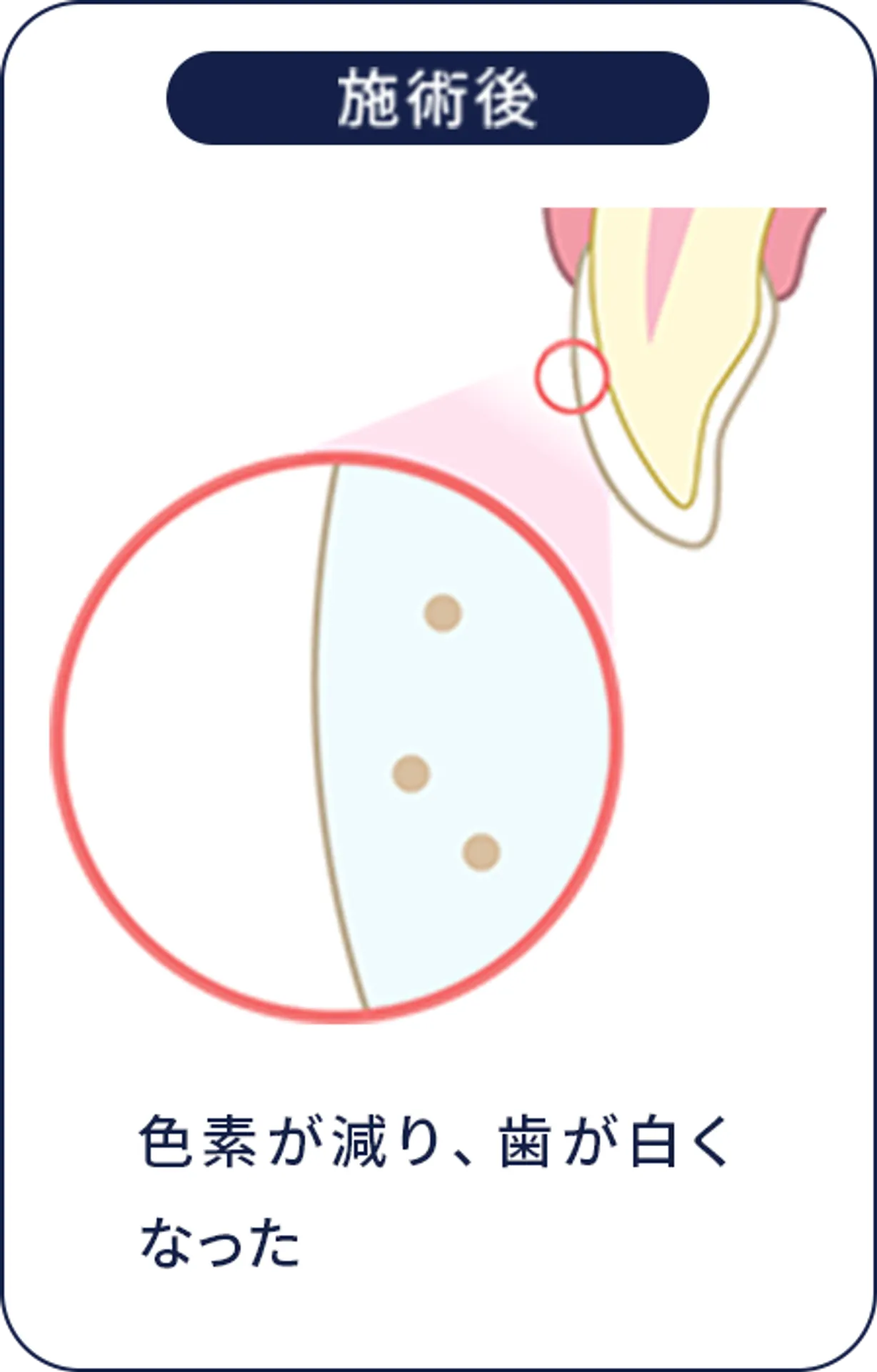 施術後